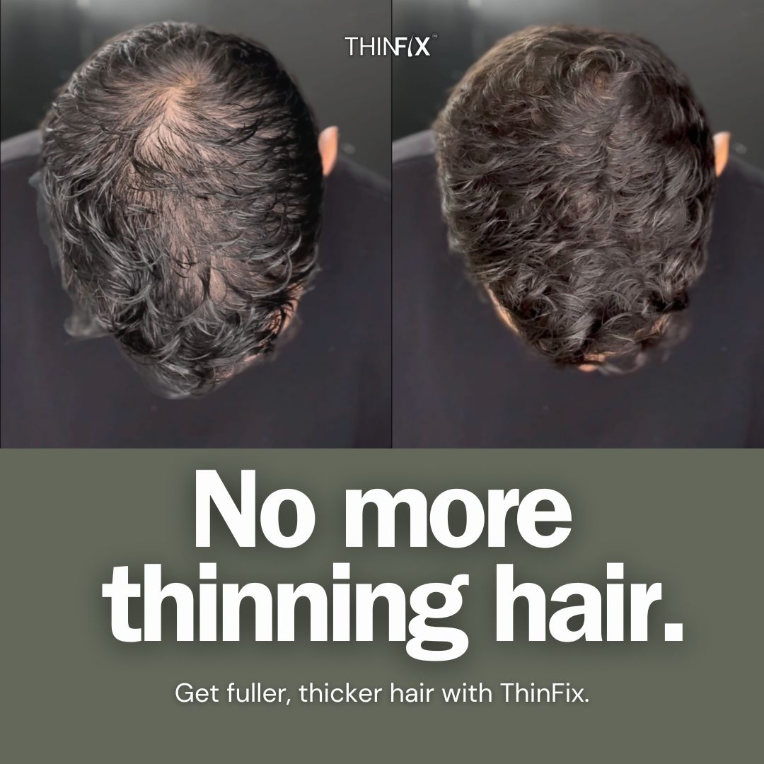 THINFIX® Hair Growth Serum